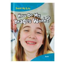 How Do My Braces Work Book